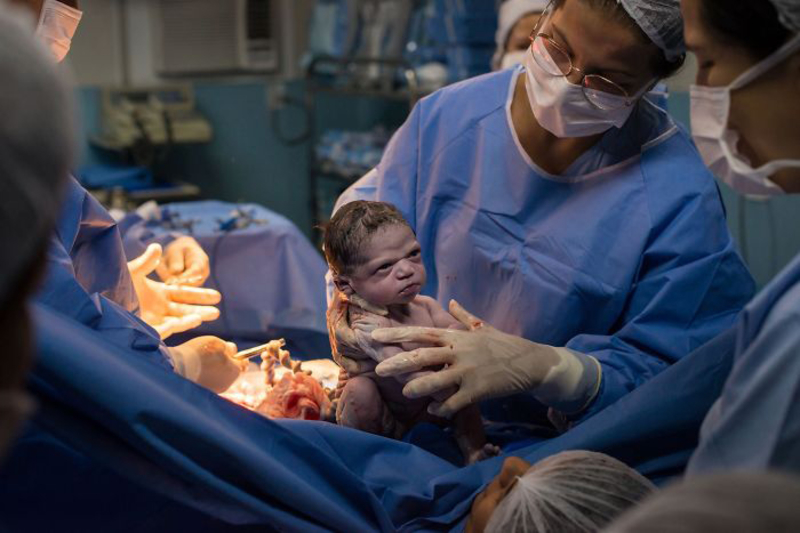 نگاه عجیب یک نوزاد هنگام تولد