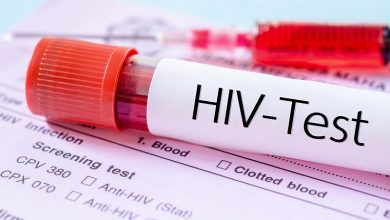 مشاوره و آزمایش ایدز در کاشان رایگان است