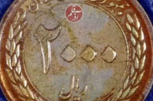 سرنوشت سکه 200 تومانی در معده کودک هفت‌ساله تبریزی [+ تصاویر]