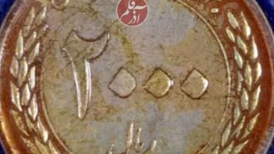 سرنوشت سکه 200 تومانی در معده کودک هفت‌ساله تبریزی [+ تصاویر]