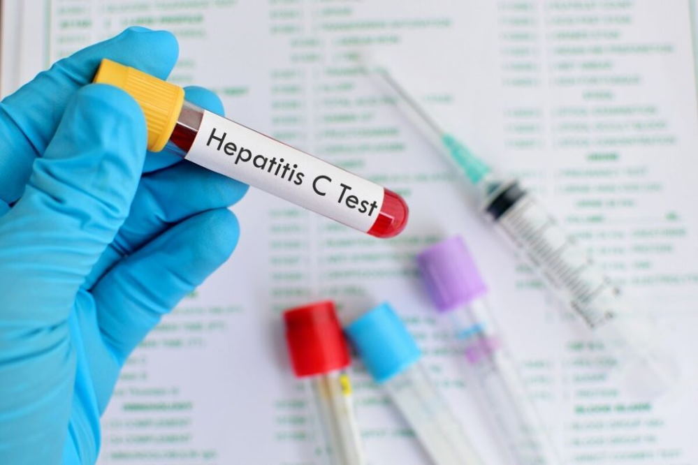 «درمان هپاتیت سی در کشور رایگان شد»