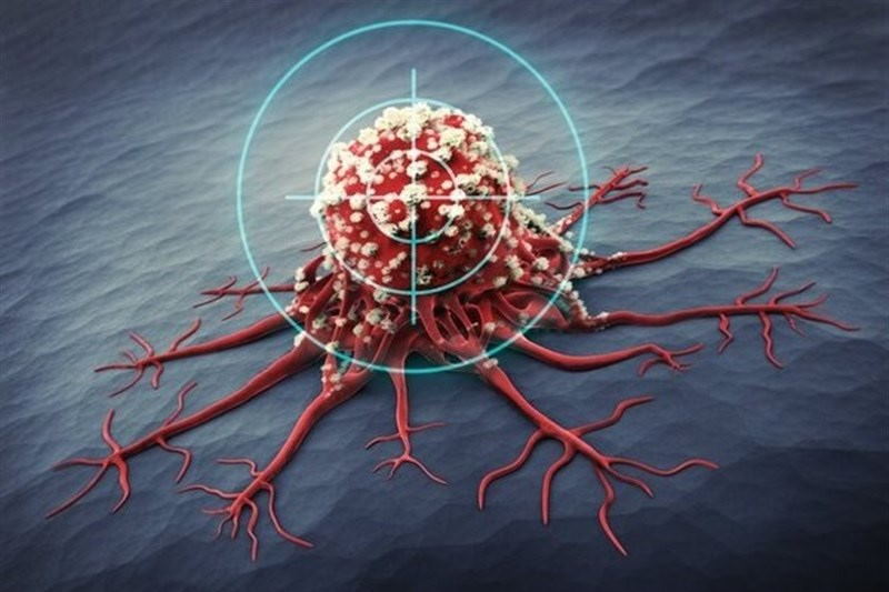 مرگ روزانه ۲۰۰ بیمار | رتبه ۴۸ ایران در رشد سرطان