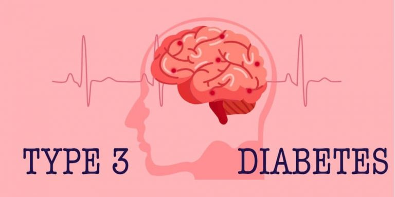 از دیابت نوع 3 چه میدانیم؟
