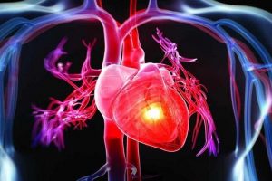 اولین عامل مرگ اردبیلی‌ها چیست؟