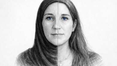 سندرم شَکدَم